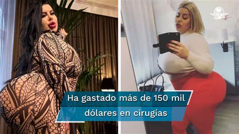 culo mas grande del mundo|Ella es la Influencer que busca tener el trasero más。